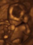 Unborn child at 17 weeks, sucking thumb and waving
